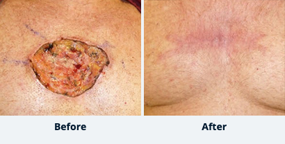 Before and After Reconstructive Surgery
