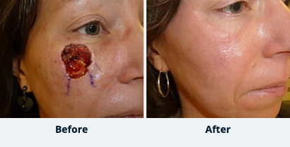 Before and After Reconstructive Surgery