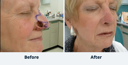 Before and After Reconstructive Surgery