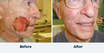Before and After Reconstructive Surgery