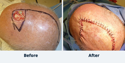 Before and After Reconstructive Surgery