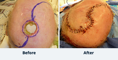Before and After Reconstructive Surgery