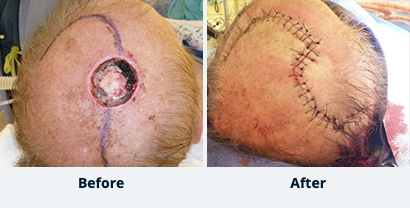 Before and After Reconstructive Surgery