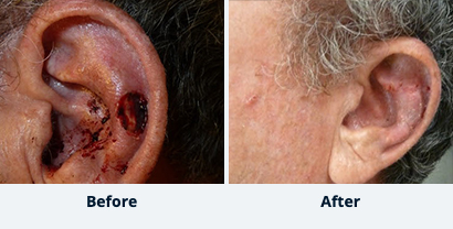 Before and After Reconstructive Surgery