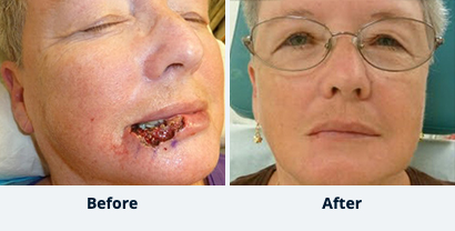 Before and After Reconstructive Surgery