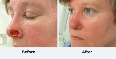 Before and After Reconstructive Surgery