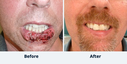 Before and After Reconstructive Surgery