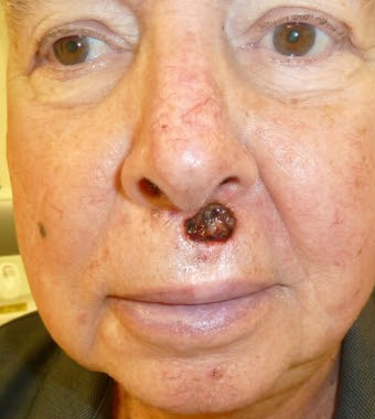 Reconstructive Surgery Before